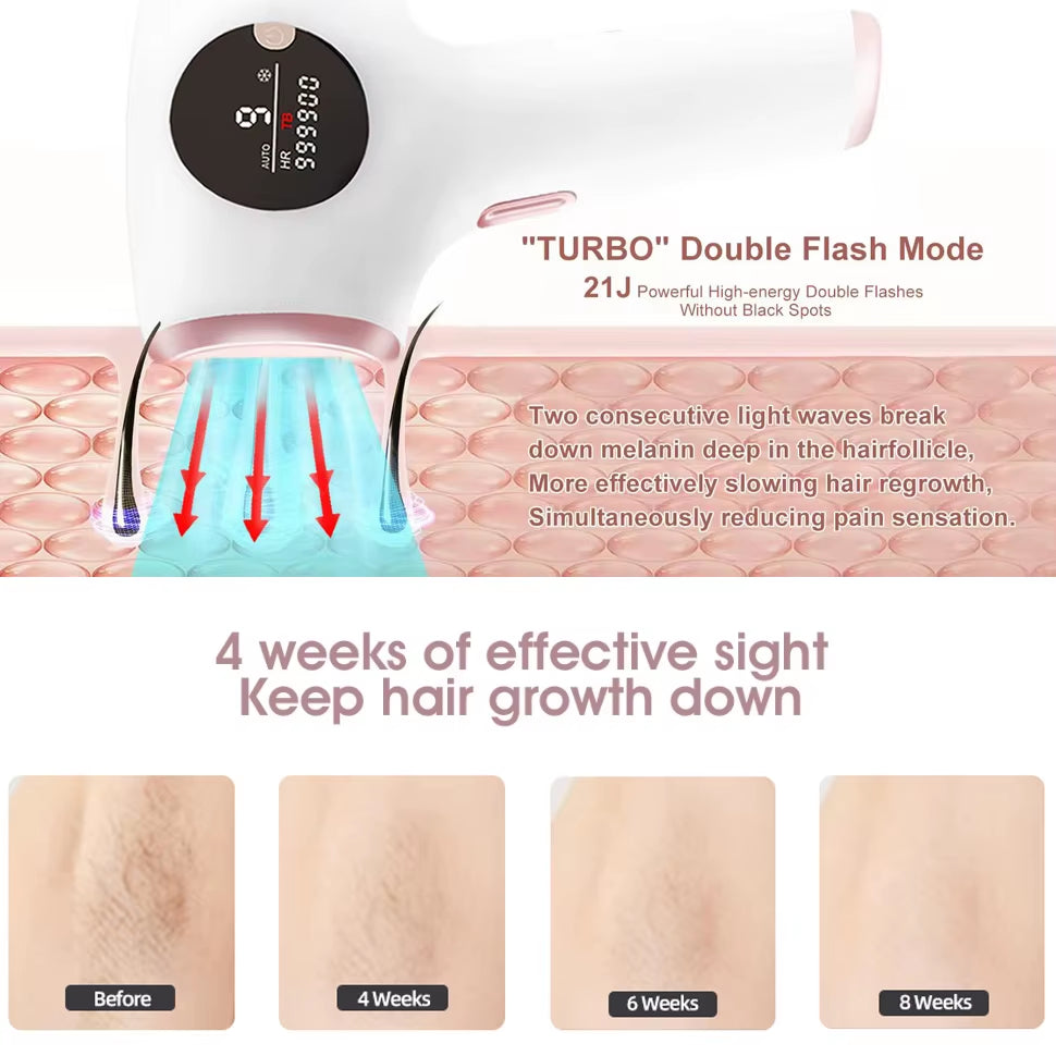 OEM Handset Laser Epilator at Home Use Permanent Facial IPL Hair Removal Device Mini Portable Laser IPL Hair Removal Machine