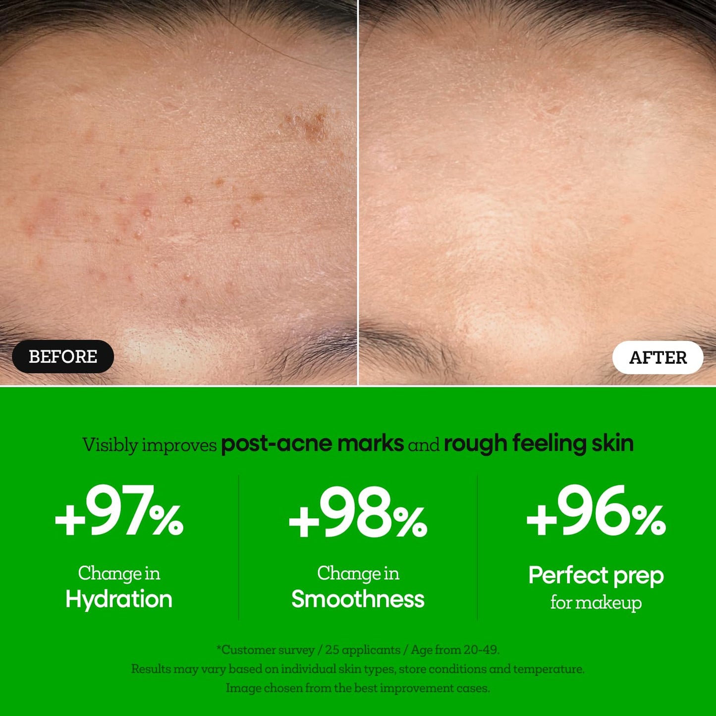 the First Peptide Boosting Serum, 8 Peptides, Niacinamide & Triple Hyaluronic Acid Complex,17 Amino Acids,For All Skin Types, Korean Skin Care150Ml/5.07 Fl Oz